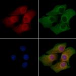 HUNK Polyclonal Antibody