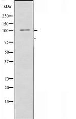MERTK Polyclonal Antibody