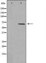 CAMKK2 Polyclonal Antibody