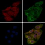 ACTBL2 Polyclonal Antibody