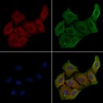 SLC44A1 Polyclonal Antibody