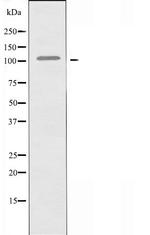 FCRL5 Polyclonal Antibody
