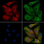 NKG2D Polyclonal Antibody