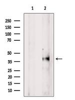 VASH1 Polyclonal Antibody