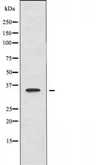 HTR5A Polyclonal Antibody
