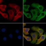 CCRD6 Polyclonal Antibody