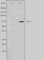 CLPTM1 Antibody in Western Blot (WB)