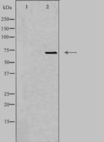 EMR3 Polyclonal Antibody