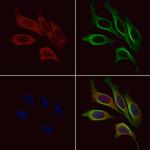 MC2R Polyclonal Antibody