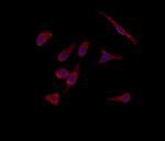 BAI1 Antibody in Immunocytochemistry (ICC/IF)