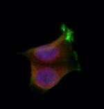 BAI1 Polyclonal Antibody