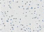 BAI1 Antibody in Immunohistochemistry (Paraffin) (IHC (P))