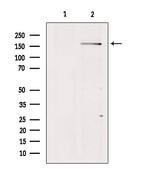 BAI1 Antibody in Western Blot (WB)