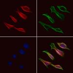 CCZ1B Antibody in Immunocytochemistry (ICC/IF)