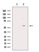 EMR4 Antibody in Western Blot (WB)