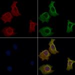 GPR108 Antibody in Immunocytochemistry (ICC/IF)