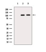 GPR113 Polyclonal Antibody