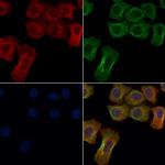 GPR114 Antibody in Immunocytochemistry (ICC/IF)