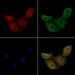 GPR144 Antibody in Immunocytochemistry (ICC/IF)
