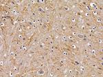 GPR156 Polyclonal Antibody