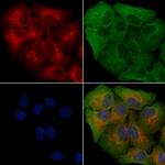 MCHR2 Polyclonal Antibody