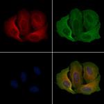 MRGPRX1 Polyclonal Antibody