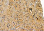 MC1R Antibody in Immunohistochemistry (Paraffin) (IHC (P))