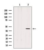 MTNR1B Polyclonal Antibody