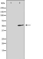 TACR3 Antibody in Western Blot (WB)