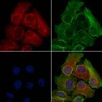 OR10G2 Polyclonal Antibody