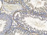 OR10G2 Antibody in Immunohistochemistry (Paraffin) (IHC (P))