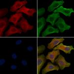 OR10J6P Polyclonal Antibody