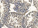 OR10J6P Antibody in Immunohistochemistry (Paraffin) (IHC (P))