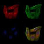 OR2AJ1 Polyclonal Antibody