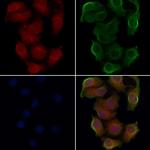 OR2T2/OR2T35 Polyclonal Antibody