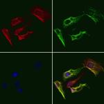 OR4F4/OR4F5/OR4F17 Polyclonal Antibody