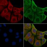 OR51T1 Polyclonal Antibody