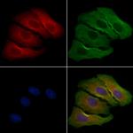 OR52A4 Polyclonal Antibody