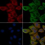 OR52B2 Polyclonal Antibody