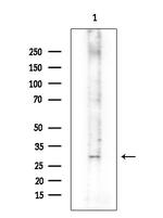 OR52B2 Antibody in Western Blot (WB)