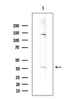 OR52B2 Antibody in Western Blot (WB)