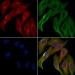 OR52E1 Polyclonal Antibody