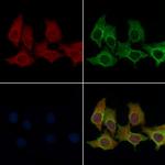 OR52E2 Polyclonal Antibody