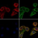 OR5AU1 Polyclonal Antibody