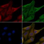 OR6C68 Polyclonal Antibody