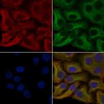 OR6C70 Polyclonal Antibody