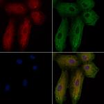 Rhodopsin Polyclonal Antibody