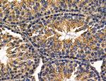 Rhodopsin Antibody in Immunohistochemistry (Paraffin) (IHC (P))