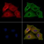 OR10D4P Polyclonal Antibody