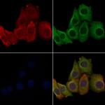 OR10G6 Polyclonal Antibody